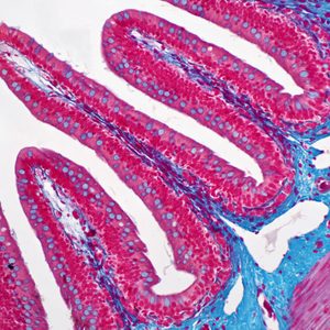 how I knew I had colon cancer