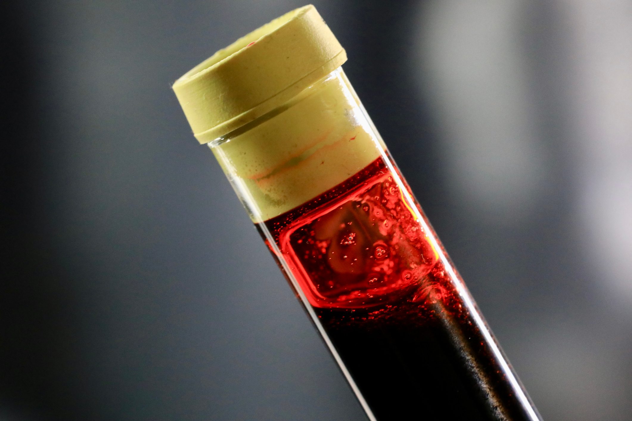 Blood Sample In A Clinic Test Tube